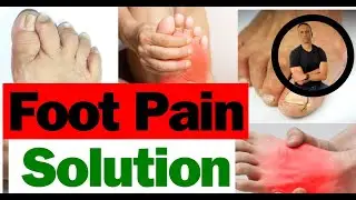 3 Foot & Toe Stretches: Bellingham Physical Therapy