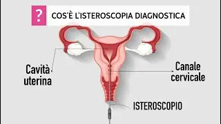 Diagnostic hysteroscopy: what it is, when it is indicated, and how it is performed