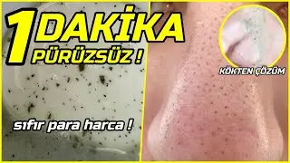 1 DAKİKADA CİLDİ YÜZÜ BEBEK GİBİ YAPAN Siyah Nokta Yok Edip Gözenek Kapatan MASKE! │ Güzellik Bakım