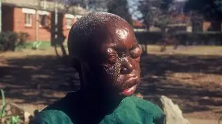 What is Ebola virus? A global emergency or a deadly diseases