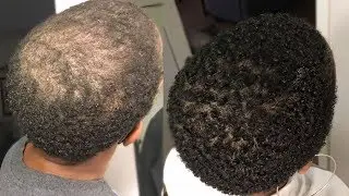 My 100% Natural HAIR GROWTH Serum  | 2 Month Update - #GrowWithMe | Nia Hope