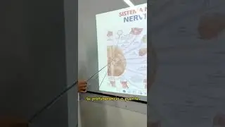 Nervios cráneales