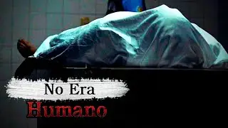 Autopsia A Un Ser Aterrador Historias De Terror - REDE