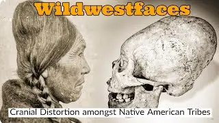 Cranial Distortion amongst Native Americans Tribes
