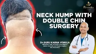 Personiks: Neck Hump Surgery & Double Chin Transformation | Dr. Guru Karna Vemula | #trending