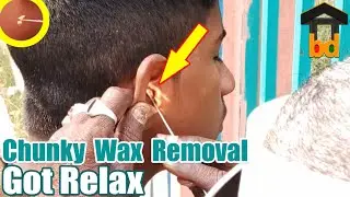 ►Teenager Ear Cleaning by Expert Guy & He Removed Chunky Wax From Left Ear II Most Satisfied Job