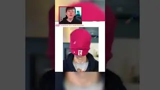 Turdboi420 CHIN REVEAL! 