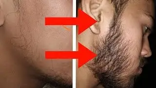 Dadhi Kaise Badhaye - Dadhi Badhane Ka Tarika - Beard Growth Oil