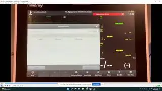 How to Delete Patients EPM 10 Anesthesia Monitor (Storage Full Error)