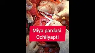 Bir jonni saqlab qolish barcha jonlarni saqlab qolish kabidir
