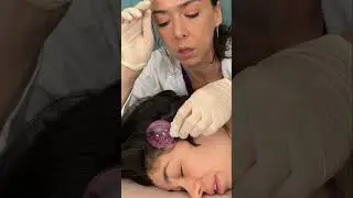 Asmr scalp tingles #asmr #asmrsounds #asmrvideo #relax #relaxing #satisfying #hair #sleep #tingles