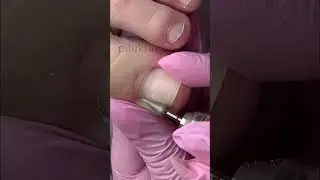 Работа фрезой капля 50 #педикюр #аппаратныйпедикюр #pedicure #nails #педикюрпошагово #ногти