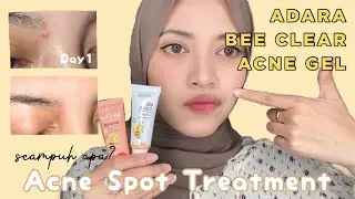 🤍 Obat Totol Jerawat Adara Bee Acne Clear Gel! Kita buktiin LAGI obat jerawat AMPUH dan MURAH ✨