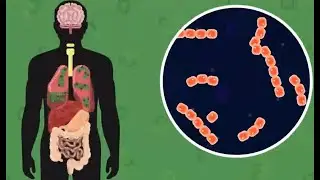 Tuberculosis (Tbc or TB for short), an infectious disease