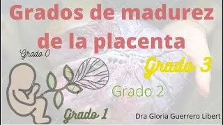 Grados Placentarios