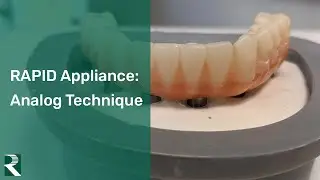 The RAPID Appliance: Analog Technique
