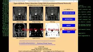 Classification Of Brain Tumor Types Using CNN Python Project With Source Code Tumor Identification