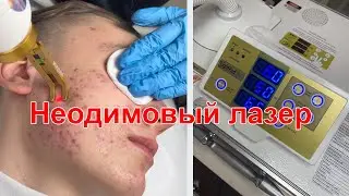 Работа неодимового лазера в кабинете косметологической клиники
