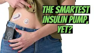 No More Carb Counting & Fewer Diabetes Decisions with iLet, the Smartest Insulin Pump Yet?