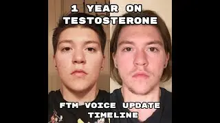 1 Year on T FTM Transgender Voice Update Timeline