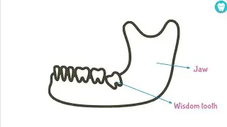 Wisdom Teeth : Frequently Asked Questions