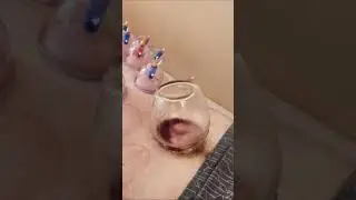 Стимуляция стволовых клеток на крестце.