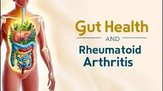 Diet and Rheumatoid Arthritis :How Food Affects Your Joints