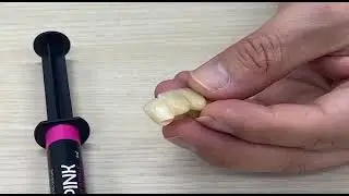Adhesión de resina rosa ID Pink en porcelana
