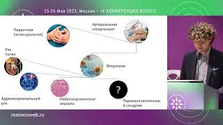 Артериальная гипертензия при противоопухолевой терапии – сравнение различных рекомендаций