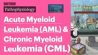 Acute Myeloid Leukemia (AML) & Chronic Myeloid Leukemia (CML) (Pathophysiology) | Sketchy Medical
