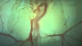 Chick Heart Looping