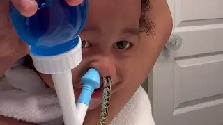 uma cobra ficou presa em seu nariz