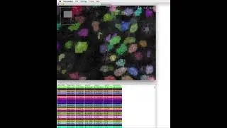 Segmented Image Exploration in Fiji