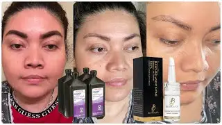 Como Estoy Eliminando la Micropigmentación De Cejas / Como Eliminar Microblading Mal Hecho ?