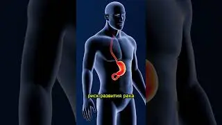 Эти продукты повышают риск рака!  #эндокринолог #диетолог #нутрициолог