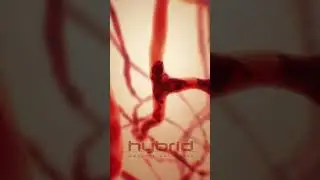 Sickle cell disease animation | #sicklecelldisease #SickleCellAnemia #hemolysis #medicalanimation