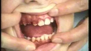 ITV SCHOOLS - GOOD HEALTH - WHITE IVORY (1981)