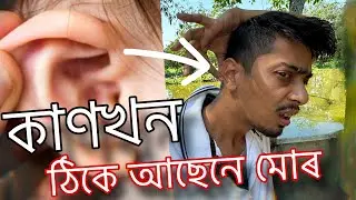 Is my Ear Okay - ঠিকে আছে নে মোৰ আপোনাৰ কাণ - Dimpu Baruah