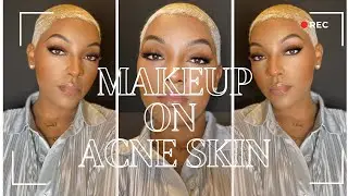 Makeup On Acne Skin