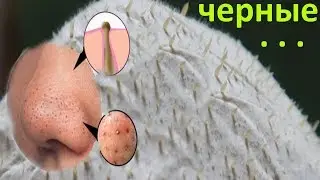 СУПЕР маска от ЧЕРНЫХ ТОЧЕК с Алиэкспресс