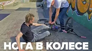 Нога застряла в колесе BMX! ЖЕСТЬ🤯