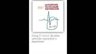 Electrocardiogram ECG