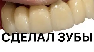 ZrO2 ceramic Сделал зубы, видео процесса. Made teeth