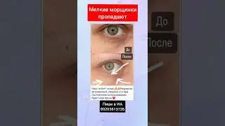 МЕЛКИЕ МОРЩИНКИ ПРОПАДАЮТ 🤩