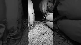 The follicle extraction process is oddly calming #hairtransplantuk #hairtransplant