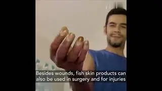 Medical innovation Fish skin bandages bring new hope to the treatment of burn wounds #innovation #ai