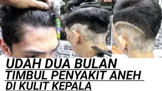 Baru dua bulan timbul penyakit aneh di bagian kulit kepala kondisi nya sangat memprihatinkan.