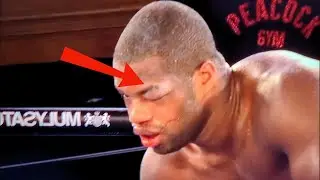 ALL Daniel Dubois Knockout Losses!