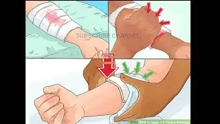உடலில் ஏற்படும் காயங்கள் விரைவில் குணமடைவது எப்படி?