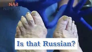 Is that Russian?  Toenails and translators (2020)